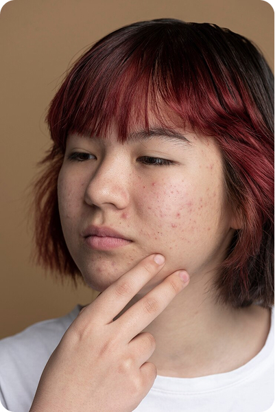 What Causes Hormonal Imbalance in Women?